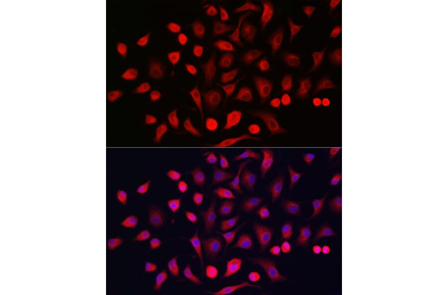 Immunofluorescence - Anti-Cytokeratin 16/K16 Antibody (A10153) - Antibodies.com