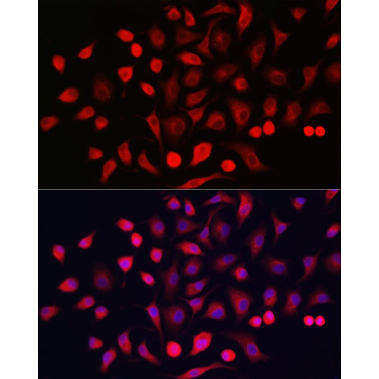 Immunofluorescence - Anti-Cytokeratin 16/K16 Antibody (A10153) - Antibodies.com