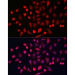 Immunofluorescence - Anti-Cytokeratin 16/K16 Antibody (A10153) - Antibodies.com