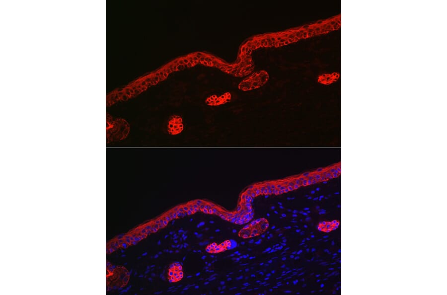 Immunofluorescence - Anti-Cytokeratin 16/K16 Antibody (A10153) - Antibodies.com