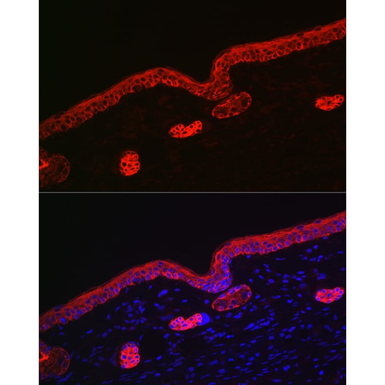Immunofluorescence - Anti-Cytokeratin 16/K16 Antibody (A10153) - Antibodies.com