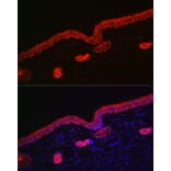 Immunofluorescence - Anti-Cytokeratin 16/K16 Antibody (A10153) - Antibodies.com