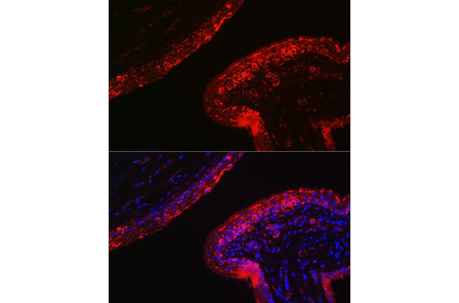 Immunofluorescence - Anti-Cytokeratin 16/K16 Antibody (A10153) - Antibodies.com