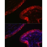Immunofluorescence - Anti-Cytokeratin 16/K16 Antibody (A10153) - Antibodies.com