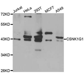 Western Blot - Anti-CSNK1G1 Antibody (A7510) - Antibodies.com