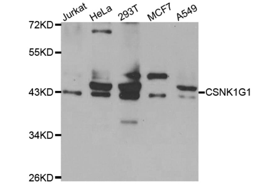 Western Blot - Anti-CSNK1G1 Antibody (A10154) - Antibodies.com