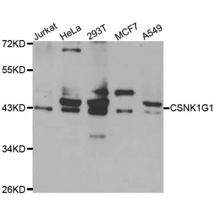 Western Blot - Anti-CSNK1G1 Antibody (A10154) - Antibodies.com