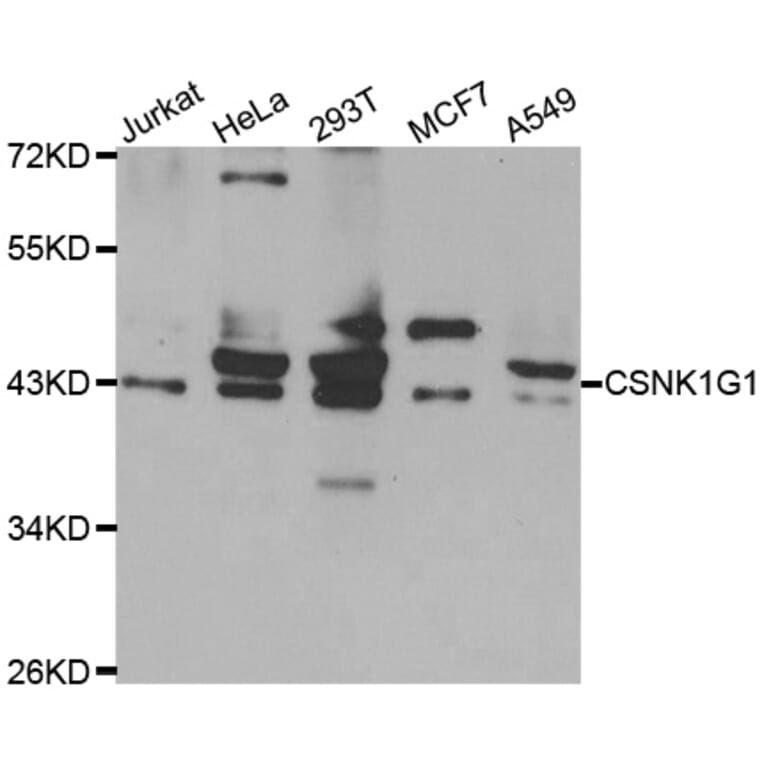 Western Blot - Anti-CSNK1G1 Antibody (A10154) - Antibodies.com