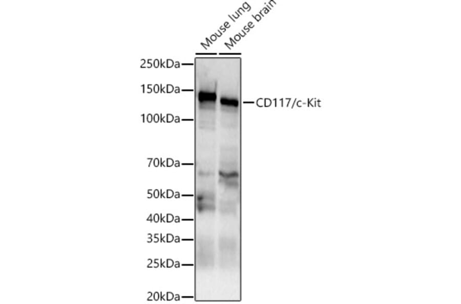 Western Blot - Anti-c-Kit Antibody (A10155) - Antibodies.com