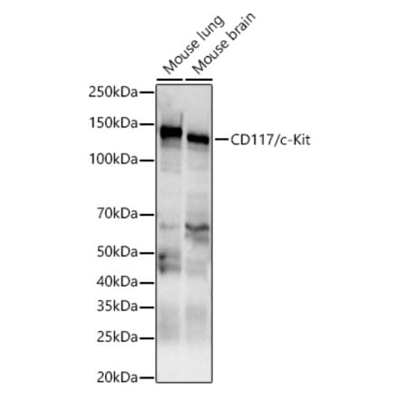 Western Blot - Anti-c-Kit Antibody (A10155) - Antibodies.com