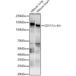 Western Blot - Anti-c-Kit Antibody (A10155) - Antibodies.com