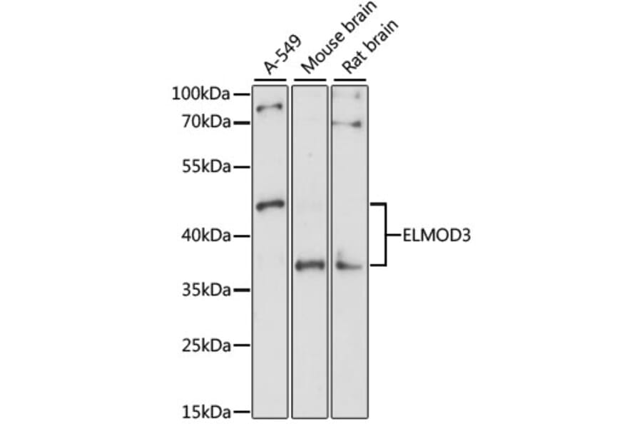 Western Blot - Anti-ELMOD3 Antibody (A10158) - Antibodies.com