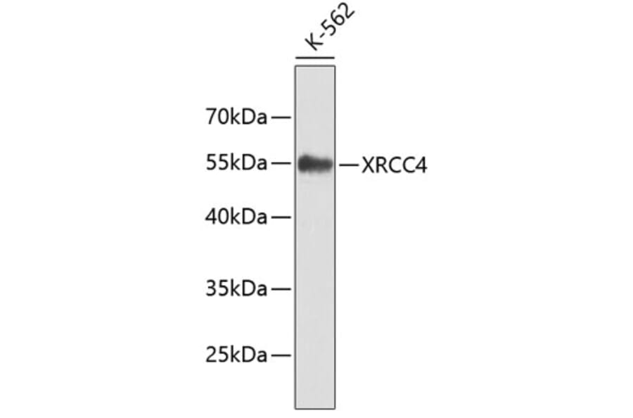 Western Blot - Anti-XRCC4 Antibody (A7539) - Antibodies.com