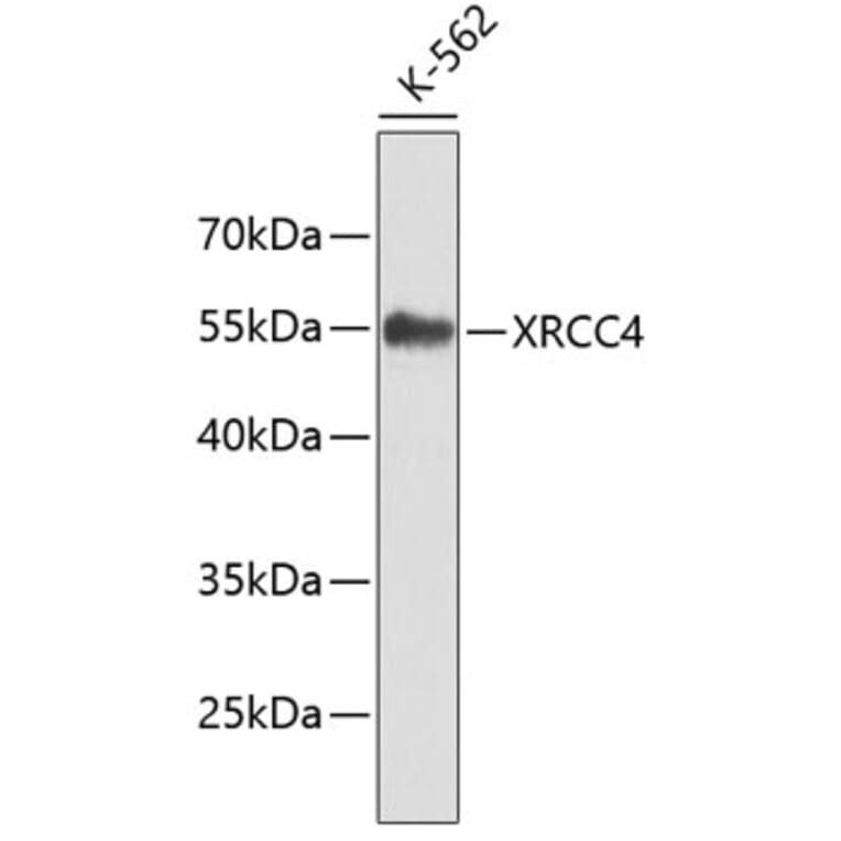 Western Blot - Anti-XRCC4 Antibody (A7539) - Antibodies.com