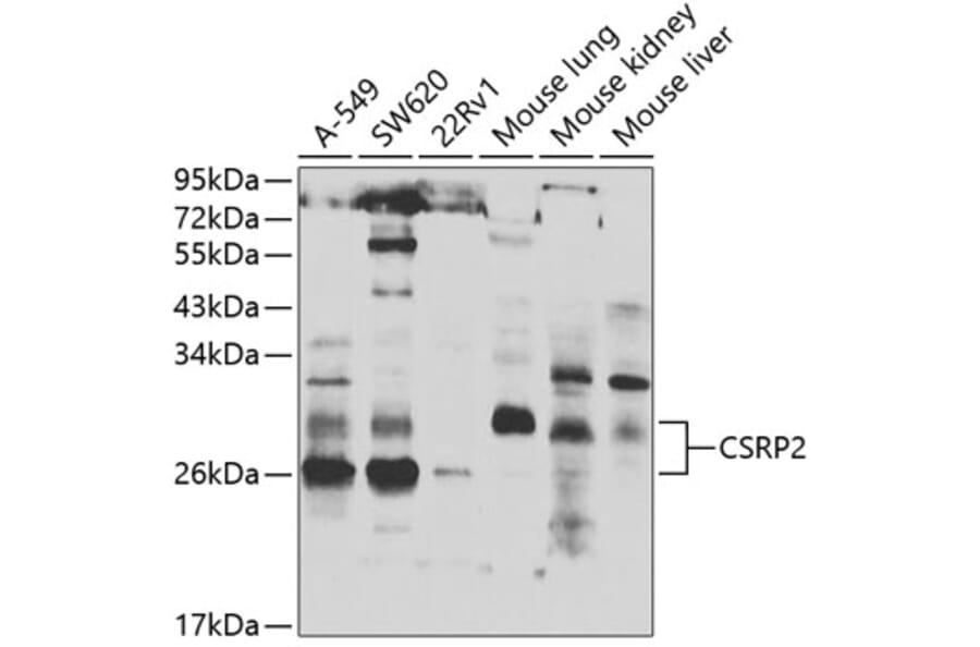 Western Blot - Anti-CSRP2/Dlp1 Antibody (A10161) - Antibodies.com