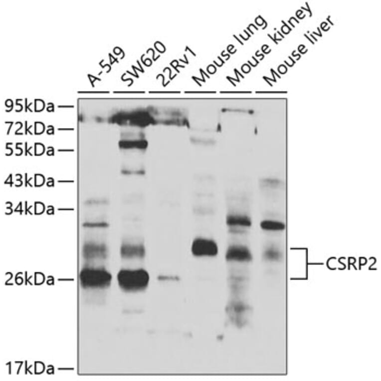 Western Blot - Anti-CSRP2/Dlp1 Antibody (A10161) - Antibodies.com