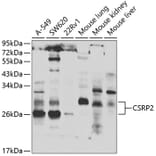 Western Blot - Anti-CSRP2/Dlp1 Antibody (A10161) - Antibodies.com