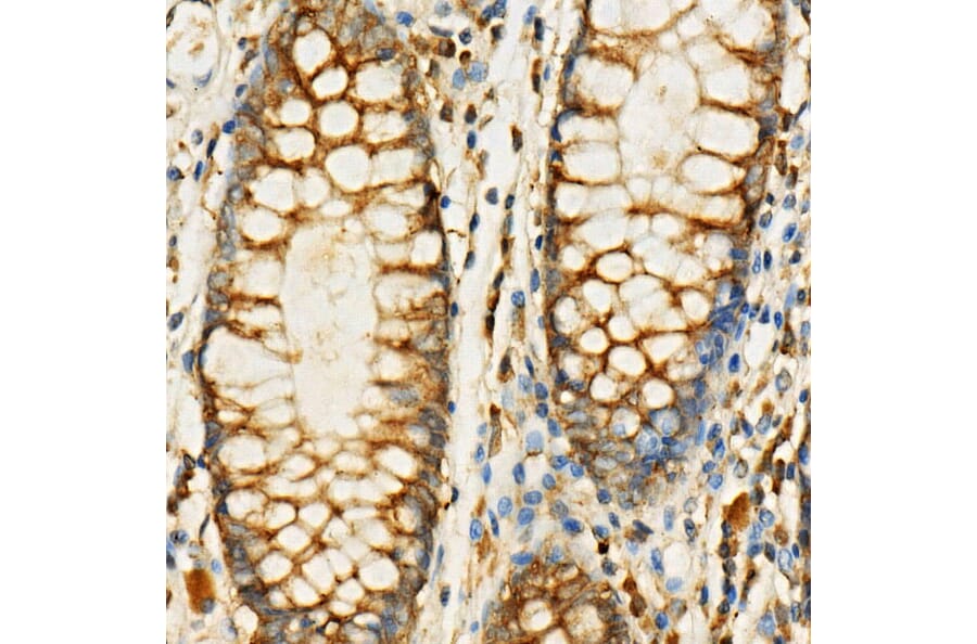 Immunohistochemistry - Anti-eIF4G1 Antibody (A10162) - Antibodies.com