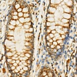 Immunohistochemistry - Anti-eIF4G1 Antibody (A10162) - Antibodies.com