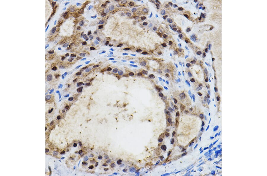 Immunohistochemistry - Anti-HIF-2-alpha Antibody (A10163) - Antibodies.com