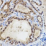 Immunohistochemistry - Anti-HIF-2-alpha Antibody (A10163) - Antibodies.com