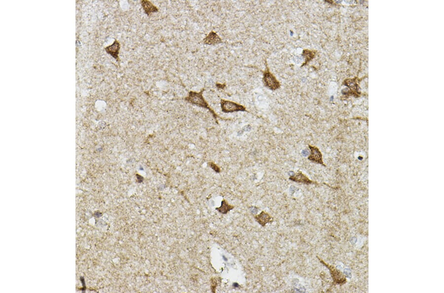 Immunohistochemistry - Anti-HIF-2-alpha Antibody (A10163) - Antibodies.com