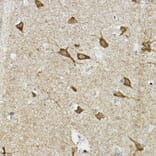 Immunohistochemistry - Anti-HIF-2-alpha Antibody (A10163) - Antibodies.com