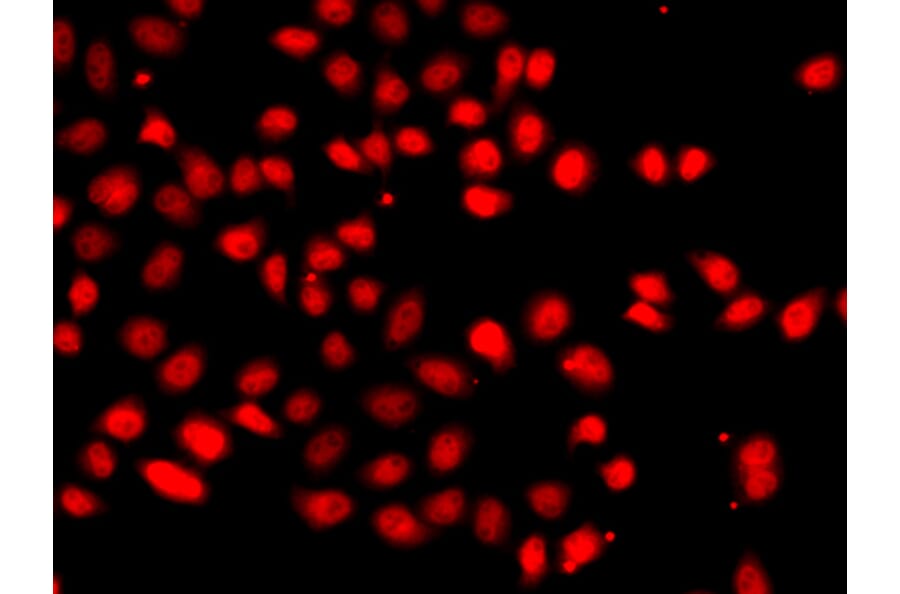 Immunofluorescence - Anti-HIF-2-alpha Antibody (A10163) - Antibodies.com