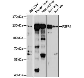 Western Blot - Anti-FGFR4 Antibody (A10164) - Antibodies.com