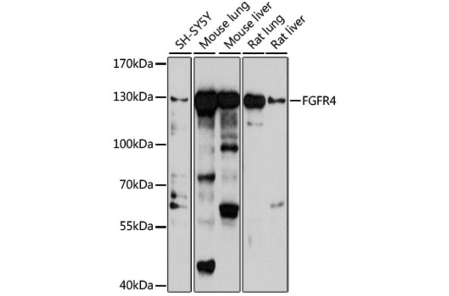 Western Blot - Anti-FGFR4 Antibody (A10164) - Antibodies.com
