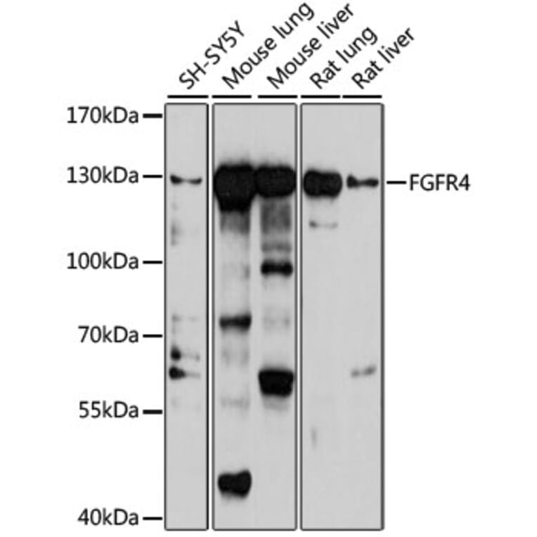 Western Blot - Anti-FGFR4 Antibody (A10164) - Antibodies.com