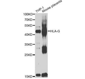 Western Blot - Anti-HLA-G Antibody (A7557) - Antibodies.com