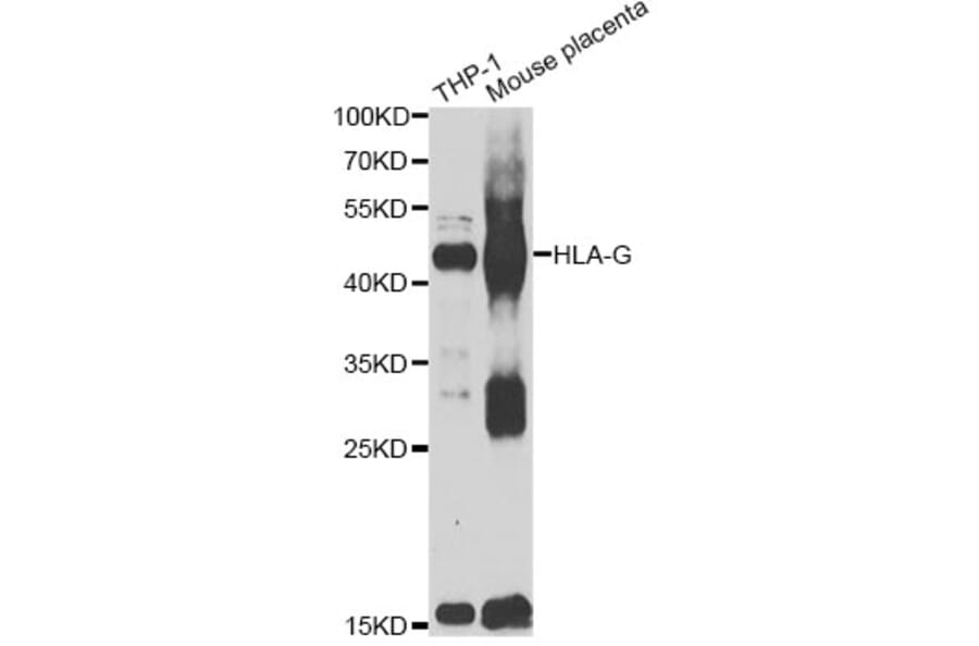 Western Blot - Anti-HLA-G Antibody (A7557) - Antibodies.com