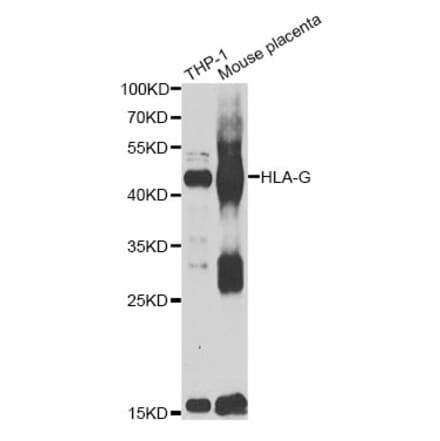 Western Blot - Anti-HLA-G Antibody (A10165) - Antibodies.com