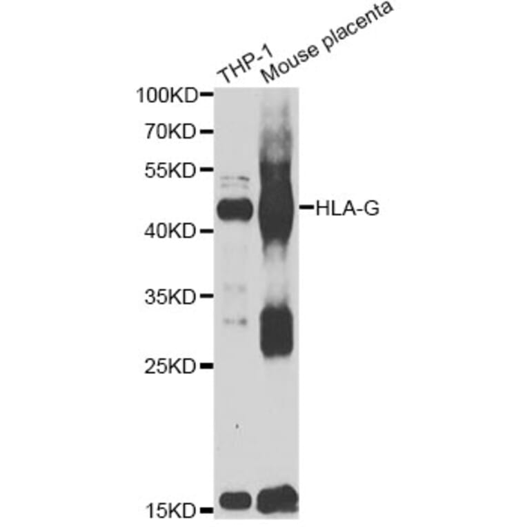 Western Blot - Anti-HLA-G Antibody (A7557) - Antibodies.com