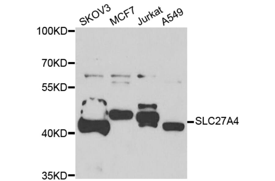 Western Blot - Anti-SLC27A4 Antibody (A7579) - Antibodies.com