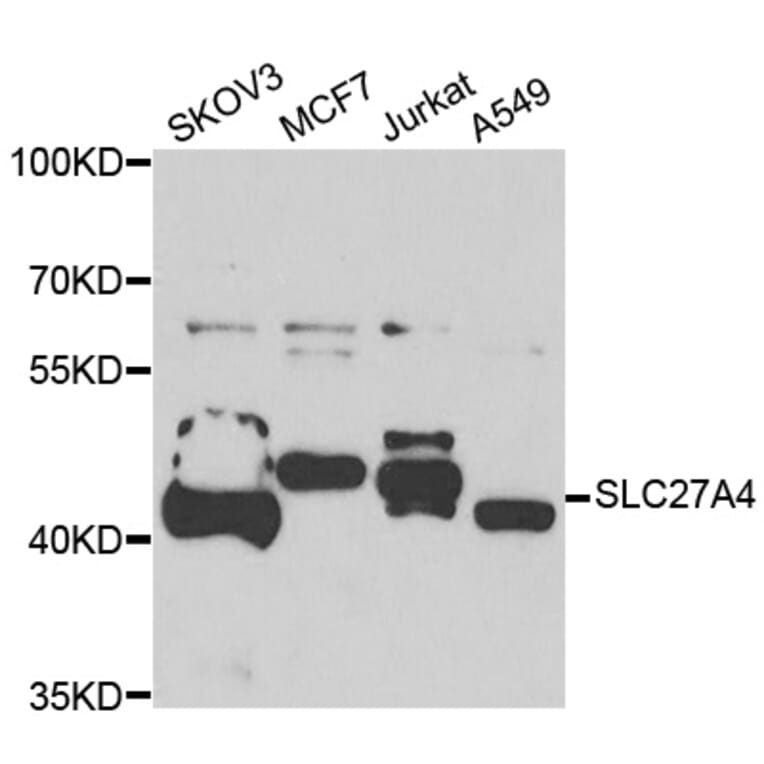 Western Blot - Anti-SLC27A4 Antibody (A7579) - Antibodies.com