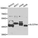 Western Blot - Anti-SLC27A4 Antibody (A7579) - Antibodies.com