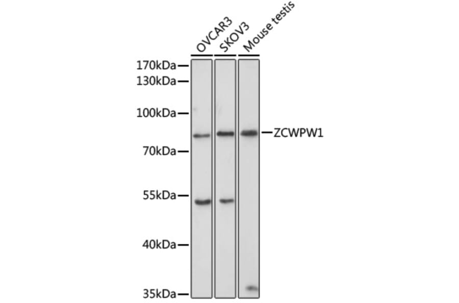 Western Blot - Anti-ZCWPW1 Antibody (A10169) - Antibodies.com