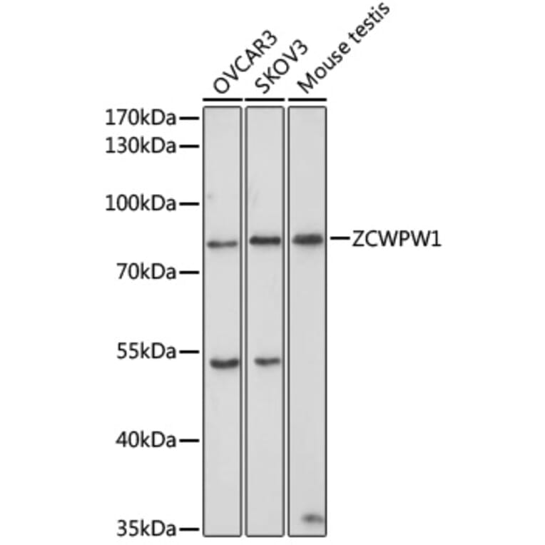 Western Blot - Anti-ZCWPW1 Antibody (A10169) - Antibodies.com