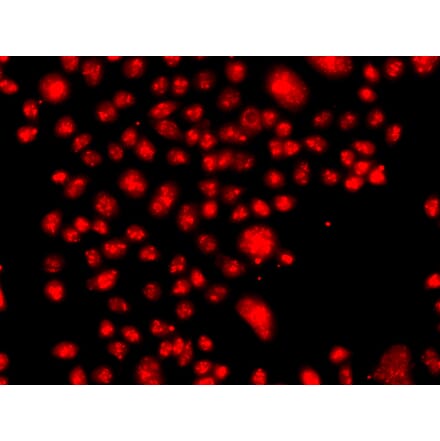 Immunofluorescence - Anti-FANCM Antibody (A10171) - Antibodies.com