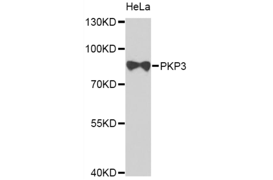 Western Blot - Anti-PKP3 Antibody (A7624) - Antibodies.com