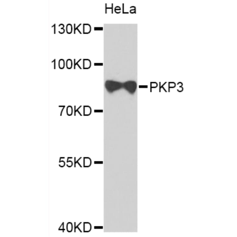Western Blot - Anti-PKP3 Antibody (A7624) - Antibodies.com