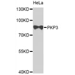 Western Blot - Anti-PKP3 Antibody (A7624) - Antibodies.com