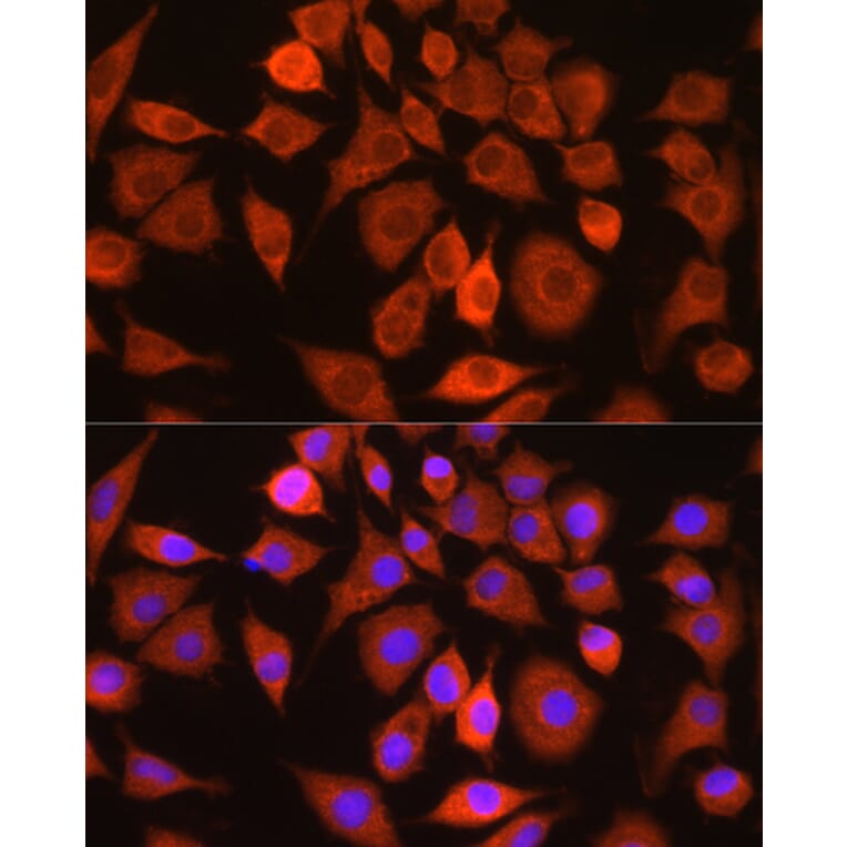 Immunofluorescence - Anti-Bax Antibody (A10174) - Antibodies.com