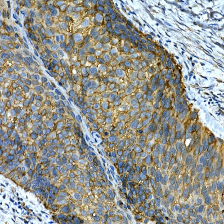 Immunohistochemistry - Anti-Integrin alpha 2 Antibody (A10175) - Antibodies.com