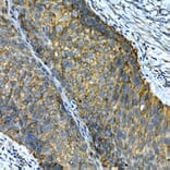 Immunohistochemistry - Anti-Integrin alpha 2 Antibody (A10175) - Antibodies.com