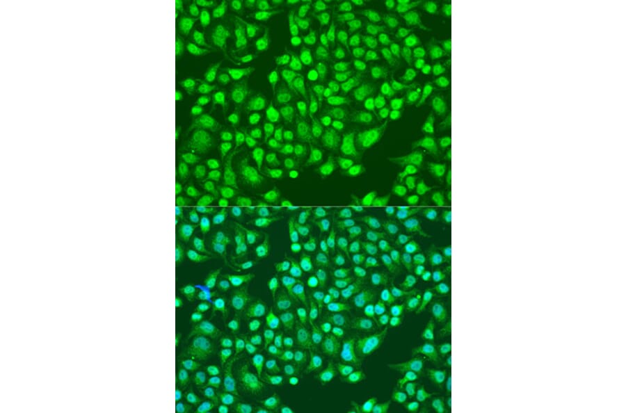 Immunofluorescence - Anti-Integrin alpha 2 Antibody (A10175) - Antibodies.com