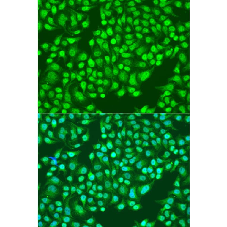 Immunofluorescence - Anti-Integrin alpha 2 Antibody (A10175) - Antibodies.com