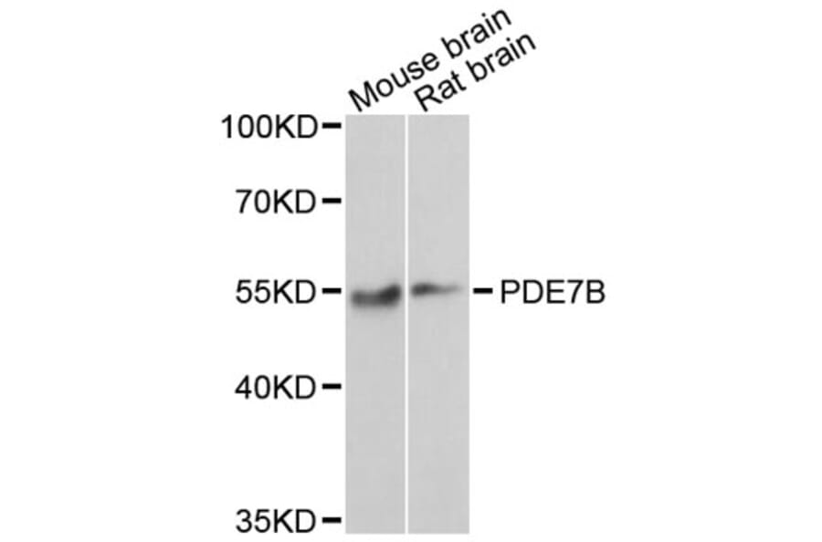 Western Blot - Anti-PDE7B Antibody (A7633) - Antibodies.com